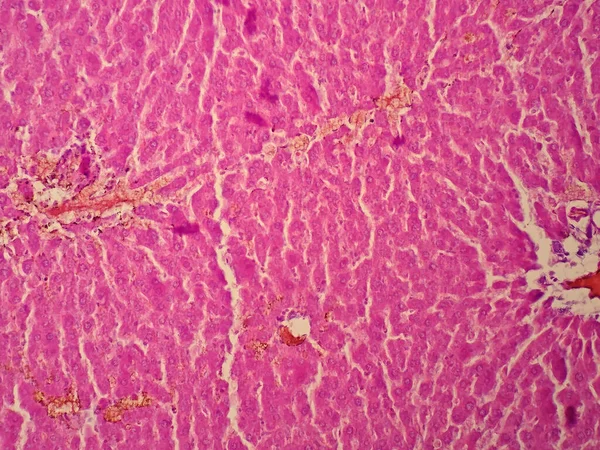 Mikroskop Altında Insan Karaciğer Dokusu — Stok fotoğraf