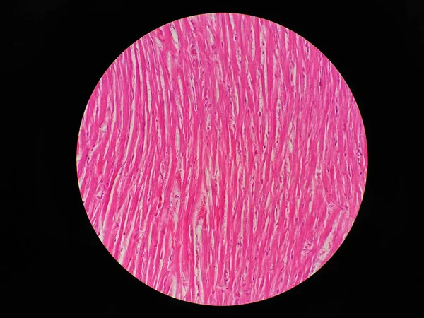 Histologia Músculo Cardíaco Humano Sob Visão Microscópica — Fotografia de Stock