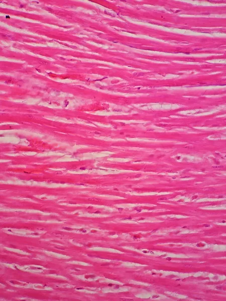 Histologia Mięśnia Sercowego Człowieka Pod Mikroskopem — Zdjęcie stockowe