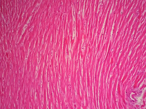 Histologia Músculo Cardíaco Humano Sob Visão Microscópica — Fotografia de Stock