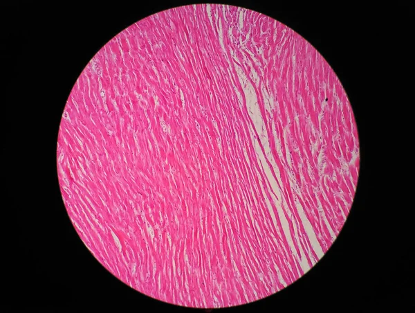 Histologia Músculo Cardíaco Humano Sob Visão Microscópica — Fotografia de Stock