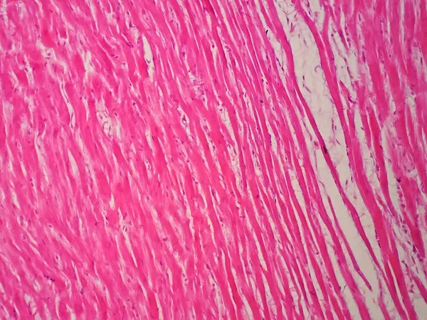 Histología Del Músculo Cardíaco Humano Bajo Microscopio Ver —  Fotos de Stock