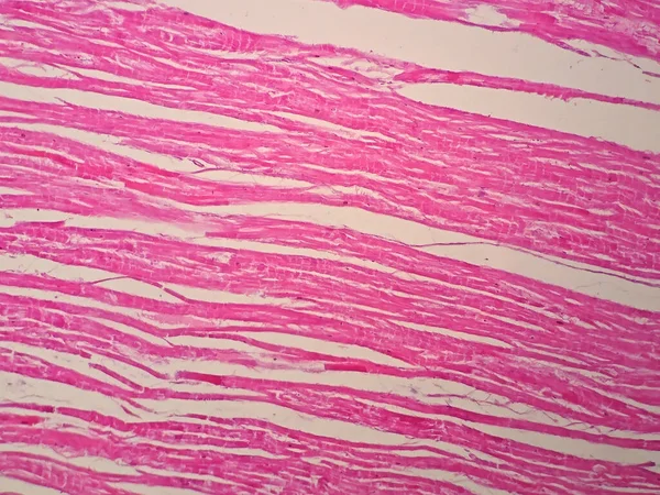 Histologie Des Herzmuskels Unter Dem Mikroskop — Stockfoto