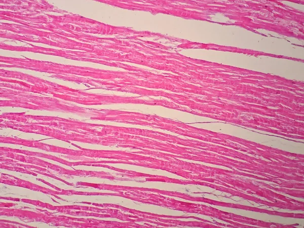 Histologie Des Menschlichen Herzmuskels Unter Dem Mikroskop — Stockfoto