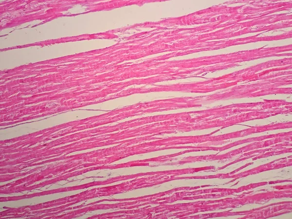 Histologie Des Herzmuskels Unter Dem Mikroskop — Stockfoto