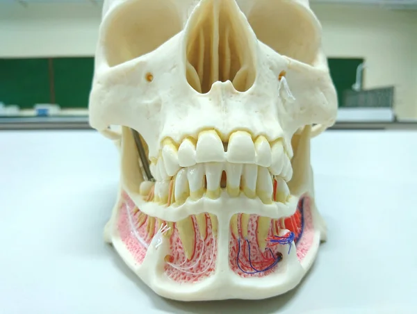 Γκρο Γκρο Πλαν Οδοντικό Μοντέλο Που Δείχνει Πόνο Περιβλήματος Τερηδόνας — Φωτογραφία Αρχείου