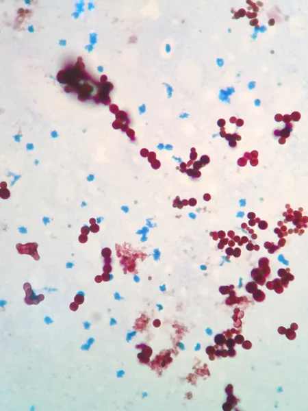 Mycobacterium Sont Aux Bactéries Qui Causent Tuberculose Chez Les Poissons — Photo