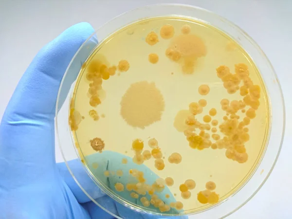 Colony Bacteria Culture Medium Plate Microbiology — Stock Photo, Image