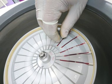 Laboratuvarda kan testi makinesi.   