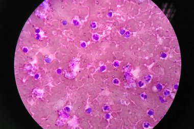 Mikroskop altında insan kan hücreleri