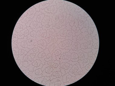 Yaprak üst derisi mikroskop altında