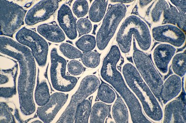 Mikroskop altında insan testisleri. Spermatogoni, mayoz, spermatid ve spermatozoa 'yı gösteriyor.                                