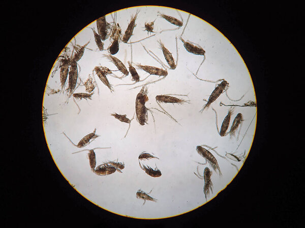 Copepods are a group of small crustaceans found in the sea and nearly every freshwater habitat, are under microscope view.