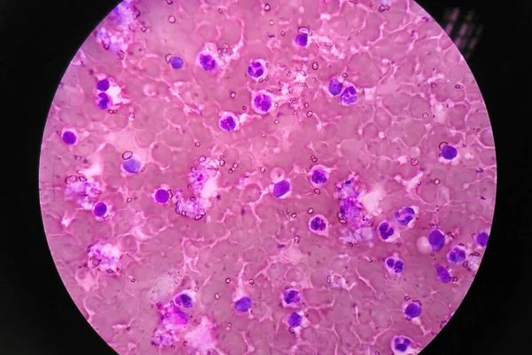 Mikroskop Altında Insan Kan Hücreleri — Stok fotoğraf