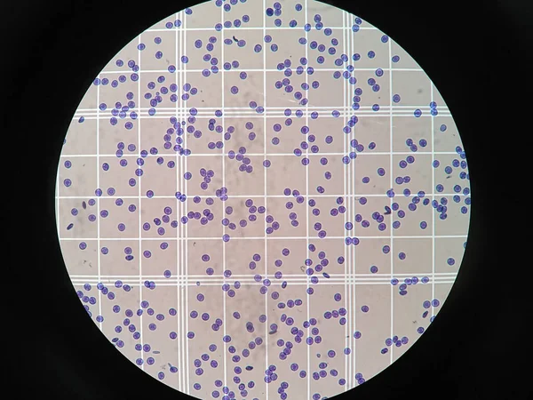 Vérsejtek Mérlegszámláló Kamrában — Stock Fotó