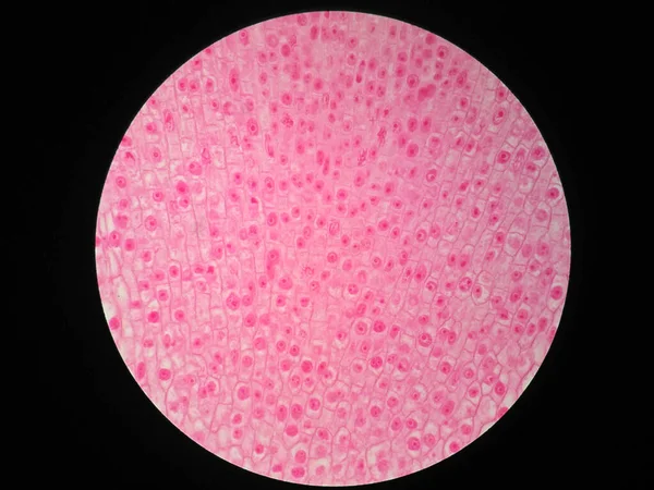Növénygyökér Keresztmetszete Mikroszkóp Alatt Aktív Osztódó Sejtek Szöveti Megjelenítése — Stock Fotó