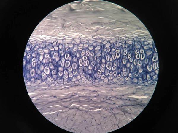 Sección Transversal Hueso Del Cartílago Humano Bajo Microscopio Ver —  Fotos de Stock