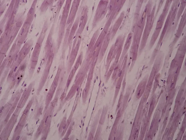 Histologie Des Herzmuskels Unter Dem Mikroskop — Stockfoto