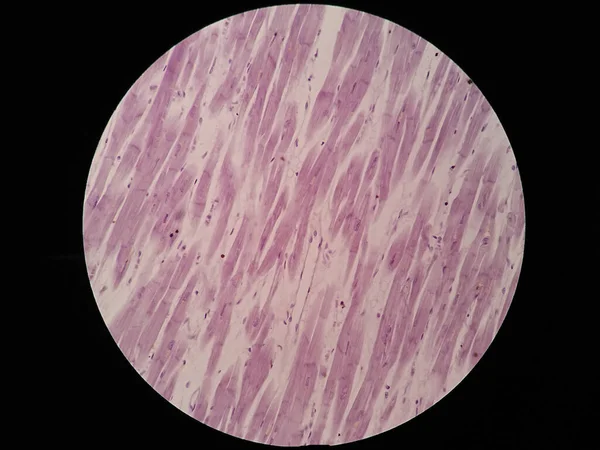 Histologie Des Herzmuskels Unter Dem Mikroskop — Stockfoto