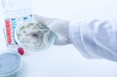 Bilim adamlarına göre orta kültür plakası mikrobiyolojide mantar kolonisi (Asperillus niger).