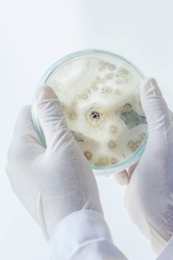 Bilim adamlarına göre orta kültür plakası mikrobiyolojide mantar kolonisi (Asperillus niger).