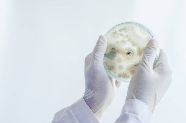 Bilim adamlarına göre orta kültür plakası mikrobiyolojide mantar kolonisi (Asperillus niger).