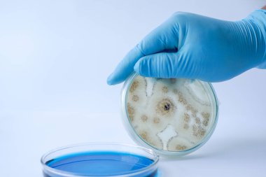 Bilim adamları, kültür orta tabakası mikrobiyolojide mantar kolonisi gösteriyor..