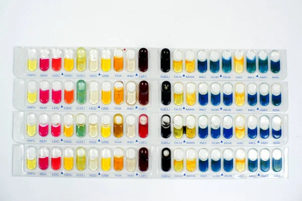 Zdravotnické Vybavení Biochemický Test — Stock fotografie