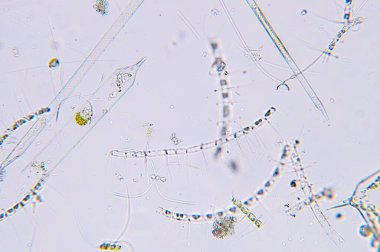 Mikroskop altında deniz planktonları