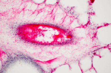 Mikroskop altında insan akciğer dokusu. Akciğerler, insanlarda ve diğer hayvanlarda solunum sisteminin birincil organlarıdır.