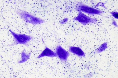 Mikroskop altında beyindeki nöron hücreleri