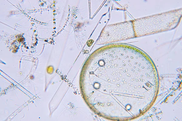 Marine aquatic plankton under the microscope view