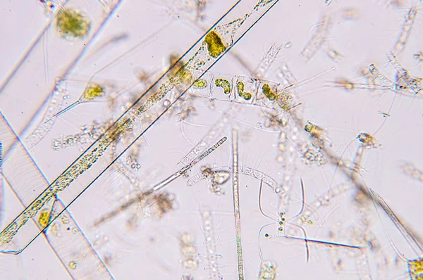 Marine aquatic plankton under the microscope view