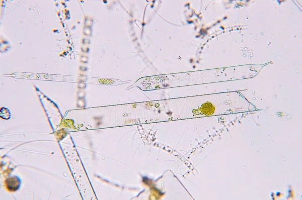 Tengeri Vízi Plankton Mikroszkóp Alatt — Stock Fotó