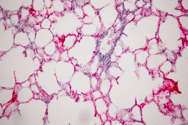 Tejido Pulmonar Humano Bajo Vista Microscopio Los Pulmones Son Los —  Fotos de Stock