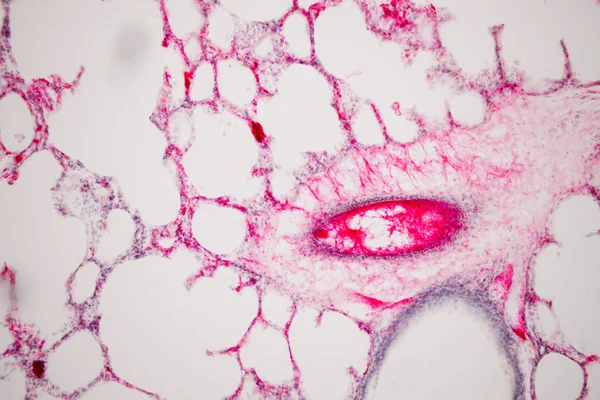 Tejido Pulmonar Humano Bajo Vista Microscopio Los Pulmones Son Los — Foto de Stock