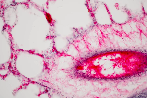 현미경으로 사람의 폐조직이다 인간과 흡기계의 기관이다 — 스톡 사진