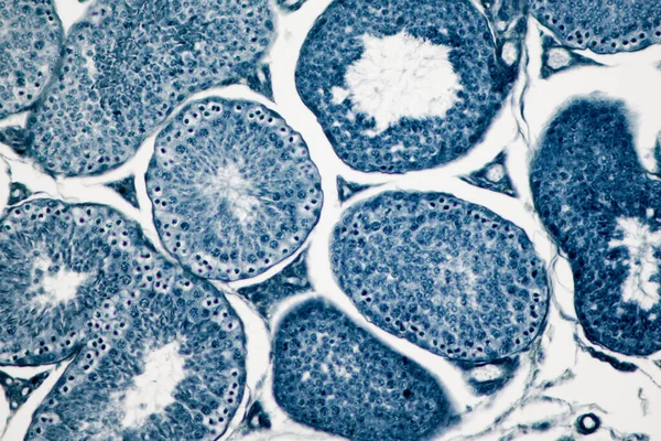 Поперечний Переріз Тести Людини Під Мікроскопом Показує Сперматогонію Сперматоцити Мейозі — стокове фото