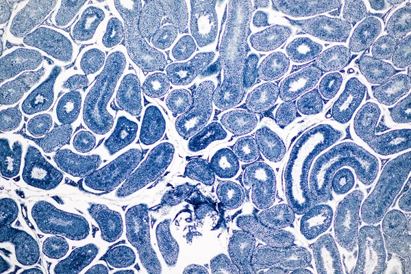 断面顕微鏡観察下での人間の検査 表示されます精子 減数分裂の精子細胞 — ストック写真