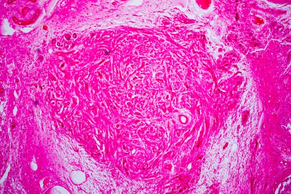 Поперечное Сечение Яичника Человека Микроскопом View Яичника Является Яйцеклетка Производящего — стоковое фото