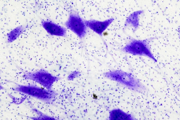 Neuronen Cellen Uit Hersenen Onder Microscoop Bekijken — Stockfoto