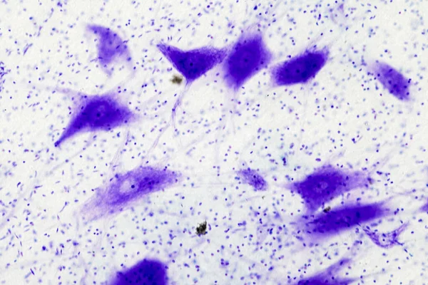 Neuronen Cellen Uit Hersenen Onder Microscoop Bekijken — Stockfoto