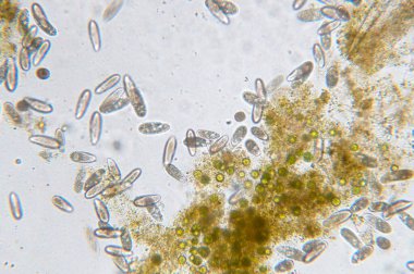 Tetrahymena, mikroskop altında tek hücreli bir protozoan ve bakteri cinsidir.