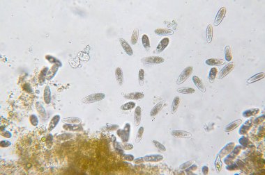 Tetrahymena, mikroskop altında tek hücreli bir protozoan ve bakteri cinsidir.