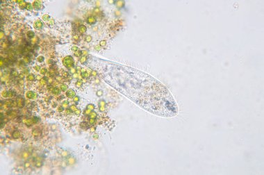 Paramesyum caudatum, mikroskop altında tek hücreli bir protozoan ve bakteri cinsidir.