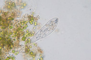Paramesyum caudatum, mikroskop altında tek hücreli bir protozoan ve bakteri cinsidir.
