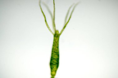 Hydra, Cnidaria cinsi ve Hydrozoa cinsi bir tatlı su hayvanıdır..