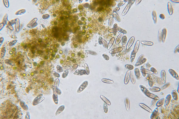 四合子属是显微镜下单细胞纤毛原生动物和细菌的一个属 — 图库照片
