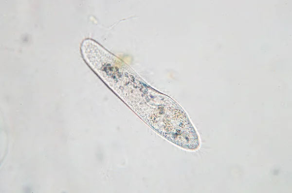 Paramesyum caudatum, mikroskop altında tek hücreli bir protozoan ve bakteri cinsidir.