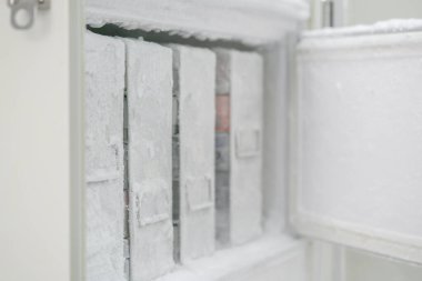 İzole edilmiş patojeni ultra düşük sıcaklıkta tutmak için laboratuvar dondurucusu.